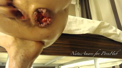 Геморройная любовь анального секса