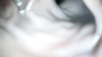 Исследование прямой кишки через анал камерой